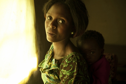 Photo of a Malawi woman and her baby.