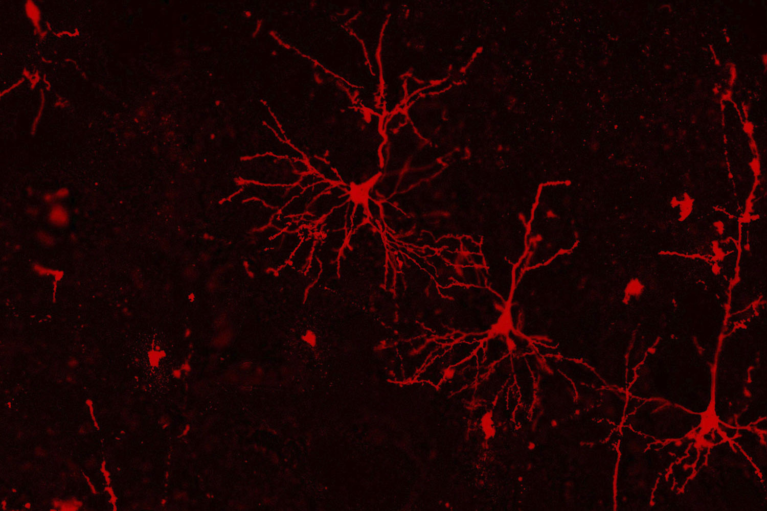 microscope image of cortical neurons