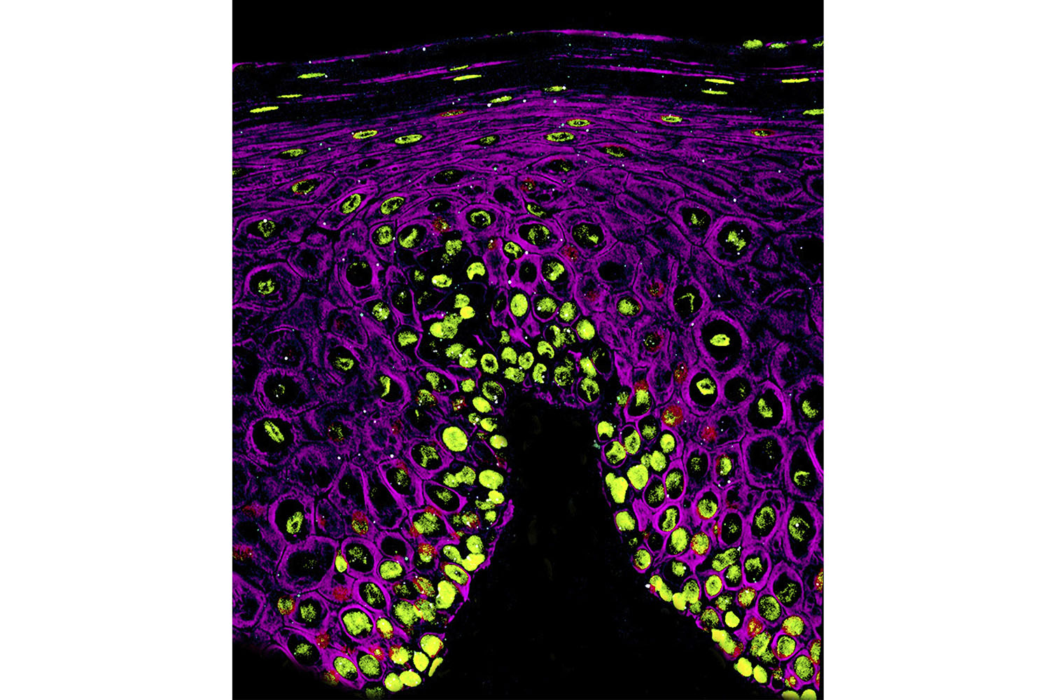 microscope image of COVID-19 infection in the mouth