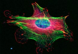 Microscopic image of a cell from James Bear's lab.