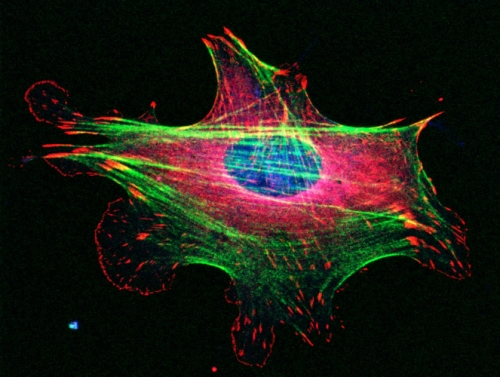 Microscopic image of a cell from James Bear's lab.