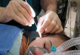 Image of a child getting ear tube replacement surgery.