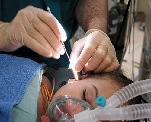 Image of a child getting ear tube replacement surgery.