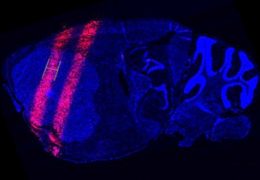 Scan of a mouse brain showing beams of radiation through it