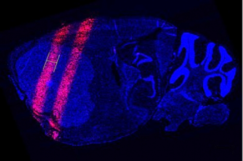 Scan of a mouse brain showing beams of radiation through it