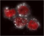 Courtesy of William Zamboni Darkfield microscopy image of cells incubated with Doxil. The Doxil particles are the small white halos, the nuclei are red, and the cytoplasm is the faint white area.