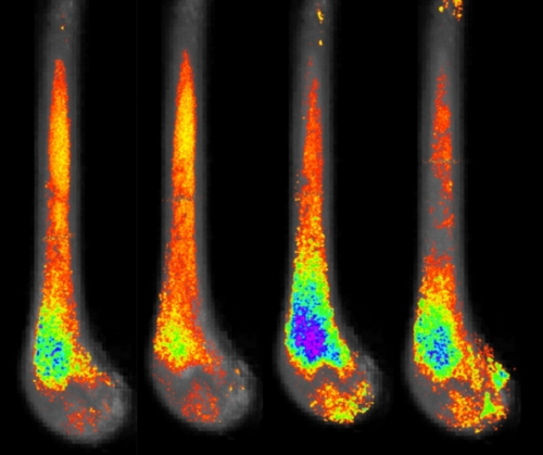 Scan of mice bones showing the level of fat in bone marrow. Far left: femur bones in sedentary mice fed a regular diet. This bone shows a medium amount of bone marrow fat. Second from left: exercising mice fed a regular diet. This shows very little amount of bone marrow fat. Third from left: sedentary mice fed a high-fat diet. This bone shows the highest amount of bone marrow fat. Far right: mice fed a high-fat diet but allowed to exercise. This bone shows a medium amount of bone marrow fat, although slightly higher than the far left bone.